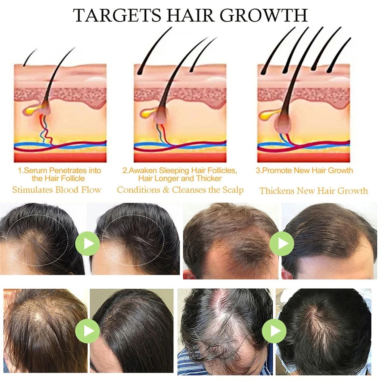 Natural Hair Growth Oil, Organic Veganic Natural Hair Growth Oil,Pure Natural Hair Density Essential Oil, Plant Extract Hair Growth Oil for Dry Damaged Hair and Growth (7Pcs)