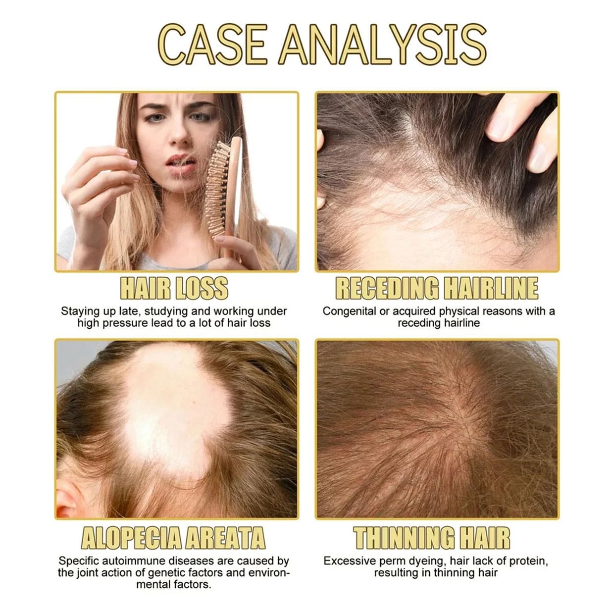 Natural Hair Growth Oil, Organic Veganic Natural Hair Growth Oil,Pure Natural Hair Density Essential Oil, Plant Extract Hair Growth Oil for Dry Damaged Hair and Growth (7Pcs)
