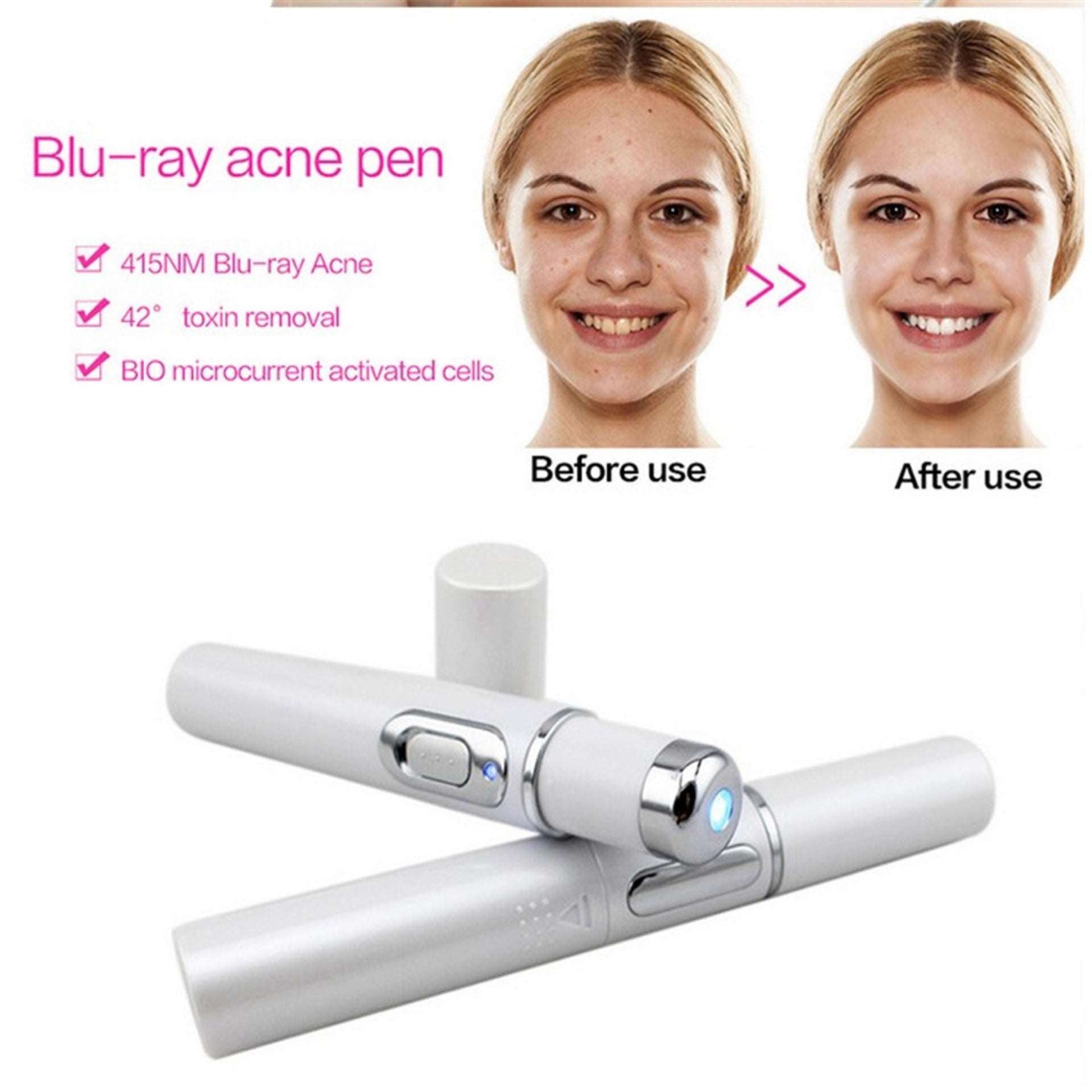 Blue Light Therapy Acne Laser Pen - Your Solution for Soft Scar & Wrinkle Removal