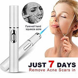 Blue Light Therapy Acne Laser Pen | Soft Scar & Wrinkle Removal Treatment Device