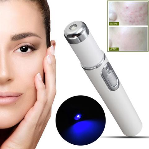Blue Light Therapy Acne Laser Pen | Soft Scar & Wrinkle Removal Treatment Device
